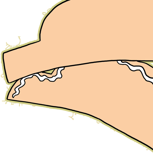 Step14